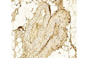 Immunohistochemical analysis of paraffin-embedded Human Skeletal muscle section using Pink1 (ABIN6242381 and ABIN6577241). (Hexokinase 2 Antikörper  (AA 1-170))