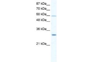DDX31 antibody used at 2. (DDX31 Antikörper)