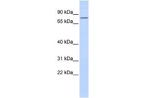 WB Suggested Anti-ZNF354A Antibody Titration:  0. (ZNF354A Antikörper  (Middle Region))