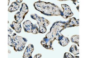 IHC analysis of MCM6 using anti-MCM6 antibody (ABIN7600038). (MCM6 Antikörper  (AA 14-821))