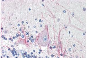 Human Brain, Cerebellum (formalin-fixed, paraffin-embedded) stained with DNASE2 antibody ABIN214485 at 5 ug/ml followed by biotinylated goat anti-rabbit IgG secondary antibody ABIN481713, alkaline phosphatase-streptavidin and chromogen. (DNASE2 Antikörper  (AA 347-360))
