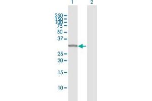 Western Blotting (WB) image for anti-Sulfotransferase Family, Cytosolic, 1A, Phenol-Preferring, Member 1 (SULT1A1) (AA 1-295) antibody (ABIN520601)