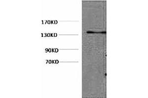 Western blot analysis of Hela, diluted at 1:1000. (HSV Tag Antikörper)