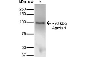 Western Blot analysis of Monkey COS-1 cells transfected with Ataxin- 1 showing detection of ~85 kDa Ataxin 1 protein using Mouse Anti-Ataxin 1 Monoclonal Antibody, Clone S65-37 . (Ataxin 1 Antikörper  (AA 746-761) (Biotin))