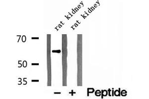 Western blot analysis of extracts of rat kidney tissue, using CKAP4 antibody. (CKAP4 Antikörper  (C-Term))