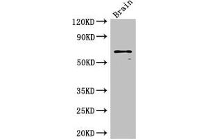 Western Blot Positive WB detected in: Mouse brain tissue All lanes: SLC6A3 antibody at 3 μg/mL Secondary Goat polyclonal to rabbit IgG at 1/50000 dilution Predicted band size: 69 kDa Observed band size: 69 kDa (SLC6A3 Antikörper  (AA 161-237))