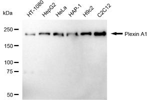 Western blotting analysis using Plexin A1 antibody (ABIN7799856). (Rekombinanter Plexin A1 Antikörper)