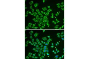Immunofluorescence analysis of HeLa cells using SMAD1 antibody. (SMAD1 Antikörper  (AA 20-240))