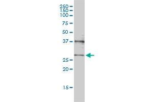 CRSP9 monoclonal antibody (M01), clone 3E7 Western Blot analysis of CRSP9 expression in Jurkat .