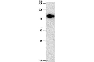 Western blot analysis of Mouse brain tissue, using DNM3 Polyclonal Antibody at dilution of 1:500 (Dynamin 3 Antikörper)