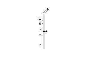 Western blot analysis of lysate from Jurkat cell line, using TYSY Antibody (C-term) (ABIN1882144 and ABIN2840937). (TYMS Antikörper  (C-Term))