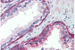 Human Prostate (formalin-fixed, paraffin-embedded) stained with UBE2L3 antibody ABIN462238 followed by biotinylated goat anti-rabbit IgG secondary antibody ABIN481713, alkaline phosphatase-streptavidin and chromogen. (UBE2L3 Antikörper  (C-Term))