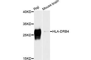 Western blot analysis of extracts of various cell lines, using HLA-DRB4 antibody (ABIN4903935) at 1:1000 dilution.