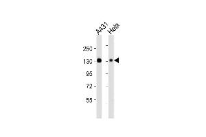 All lanes : Anti-ITGA3 Antibody (N-term) at 1:4000 dilution Lane 1: A431 whole cell lysates Lane 2: Hela whole cell lysates Lysates/proteins at 20 μg per lane. (ITGA3 Antikörper  (N-Term))