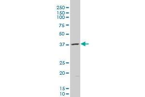 AKR1B10 polyclonal antibody (A01), Lot # UOP11060207QCS1 Western Blot analysis of AKR1B10 expression in K-562 . (AKR1B10 Antikörper  (AA 76-143))
