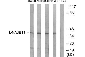 Immunohistochemistry analysis of paraffin-embedded human heart tissue using DNAJB11 antibody. (DNAJB11 Antikörper)