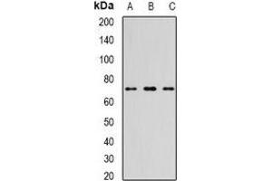 Western blot analysis of TTLL12 expression in NIH3T3 (A), mouse thymus (B), mouse heart (C) whole cell lysates. (TTLL12 Antikörper)