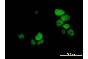 Immunofluorescence of monoclonal antibody to UHRF1 on MCF-7 cell. (UHRF1 Antikörper  (AA 694-793))