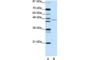 Western Blotting (WB) image for anti-Tripartite Motif Containing 14 (TRIM14) antibody (ABIN2461040) (TRIM14 Antikörper)