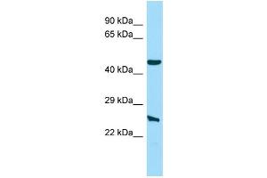 Host: Rabbit Target Name: NIPAL4 Sample Type: Hela Whole Cell lysates Antibody Dilution: 1. (NIPAL4 Antikörper  (N-Term))