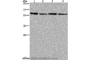 Western blot analysis of Mouse kidney, liver, heart and brain tissue, using ART4 Polyclonal Antibody at dilution of 1:667 (ART4 Antikörper)