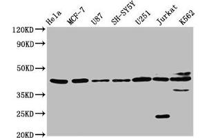 Western Blot Positive WB detected in: Hela whole cell lysate, MCF-7 whole cell lysate, U87 whole cell lysate, SH-SY5Y whole cell lysate, U251 whole cell lysate, Jurkat whole cell lysate, K562 whole cell lysate All lanes: NPY2R antibody at 3. (NPY2R Antikörper  (AA 326-381))