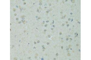 Immunohistochemistry of paraffin-embedded Rat brain using TRIM28 Polyclonal Antibody at dilution of 1:100 (40x lens). (KAP1 Antikörper)