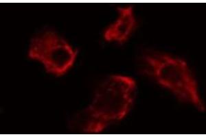 ABIN6275482 staining Hela cells by IF/ICC. (RGS7 Antikörper  (Internal Region))