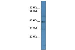 WB Suggested Anti-MAGEC2 Antibody Titration: 0.