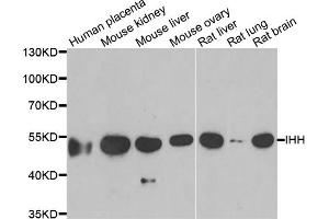 Western blot analysis of extracts of various cell lines, using IHH antibody (ABIN5973985) at 1/1000 dilution. (Indian Hedgehog Antikörper)
