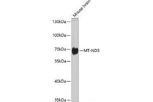 Western blot analysis of extracts of various cell lines using MT-ND5 Polyclonal Antibody at dilution of 1:1000. (MT-ND5 Antikörper)