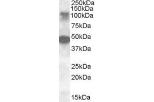 Image no. 2 for anti-serine/threonine Kinase 11 Interacting Protein (STK11IP) (AA 732-746) antibody (ABIN490511) (STK11IP Antikörper  (AA 732-746))