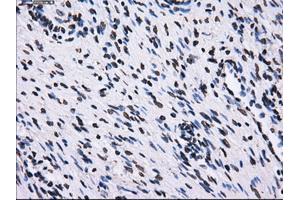 Immunohistochemical staining of paraffin-embedded colon tissue using anti-RPA2 mouse monoclonal antibody. (RPA2 Antikörper)