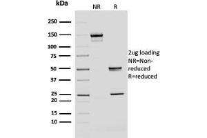SDS-PAGE Analysis Purified BMI1 Mouse Monoclonal Antibody (BMI1/2690). (BMI1 Antikörper  (AA 142-326))