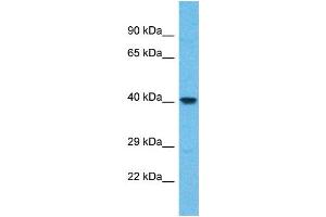 Western Blotting (WB) image for anti-WD Repeat Domain 86 (WDR86) (N-Term) antibody (ABIN2791988) (WDR86 Antikörper  (N-Term))