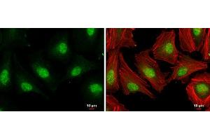 Immunofluorescence (IF) image for anti-E2F Transcription Factor 1 (E2F1) antibody (ABIN2854981)