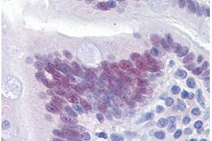 Human Small intestine: Formalin-Fixed, Paraffin-Embedded (FFPE) (CDX2 Antikörper  (AA 1-314))