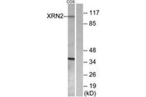 Western Blotting (WB) image for anti-5'-3' Exoribonuclease 2 (XRN2) (AA 81-130) antibody (ABIN2889753) (XRN2 Antikörper  (AA 81-130))