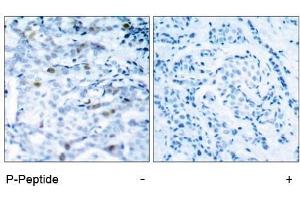 Image no. 1 for anti-Cyclin-Dependent Kinase 1 (CDK1) (pThr161) antibody (ABIN196847) (CDK1 Antikörper  (pThr161))