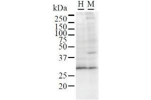 Detection of GATAD1 by Western Blot. (GATAD1 Antikörper)