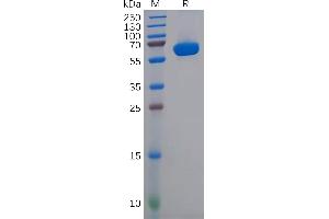 Human CD2 Protein, hFc Tag on SDS-PAGE under reducing condition.