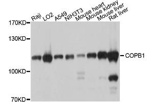 Western blot analysis of extracts of various cells, using COPB1 antibody.
