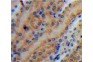 Used in DAB staining on fromalin fixed paraffin-embedded Kidney tissue (MMP7 Antikörper  (AA 1-267))