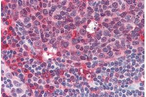 Human Tonsil (formalin-fixed, paraffin-embedded) stained with SYK antibody ABIN334248 at 10 ug/ml followed by biotinylated anti-mouse IgG secondary antibody ABIN481714, alkaline phosphatase-streptavidin and chromogen. (SYK Antikörper  (AA 5-360))