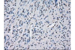 Immunohistochemical staining of paraffin-embedded endometrium tissue using anti-BUB1Bmouse monoclonal antibody. (BUB1B Antikörper)