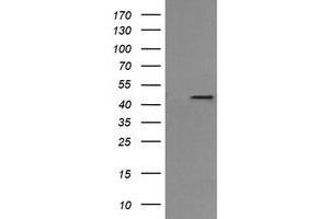 Image no. 3 for anti-Mitogen-Activated Protein Kinase Kinase 1 (MAP2K1) antibody (ABIN1499395) (MEK1 Antikörper)