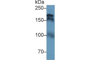 Western Blot; Sample: Human Serum; Primary Ab: 1µg/ml Rabbit Anti-Human TOP2 Antibody Second Ab: 0. (TOP2 Antikörper  (AA 923-1148))