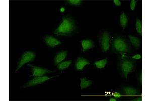 Immunofluorescence of monoclonal antibody to STIM1 on HeLa cell. (STIM1 Antikörper  (AA 24-685))
