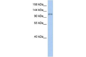 WB Suggested Anti-ZNF217 Antibody Titration:  0. (ZNF217 Antikörper  (N-Term))