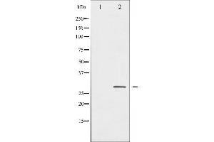 Western blot analysis of HSP27 phosphorylation expression in Ca2+ treated HeLa whole cell lysates,The lane on the left is treated with the antigen-specific peptide.